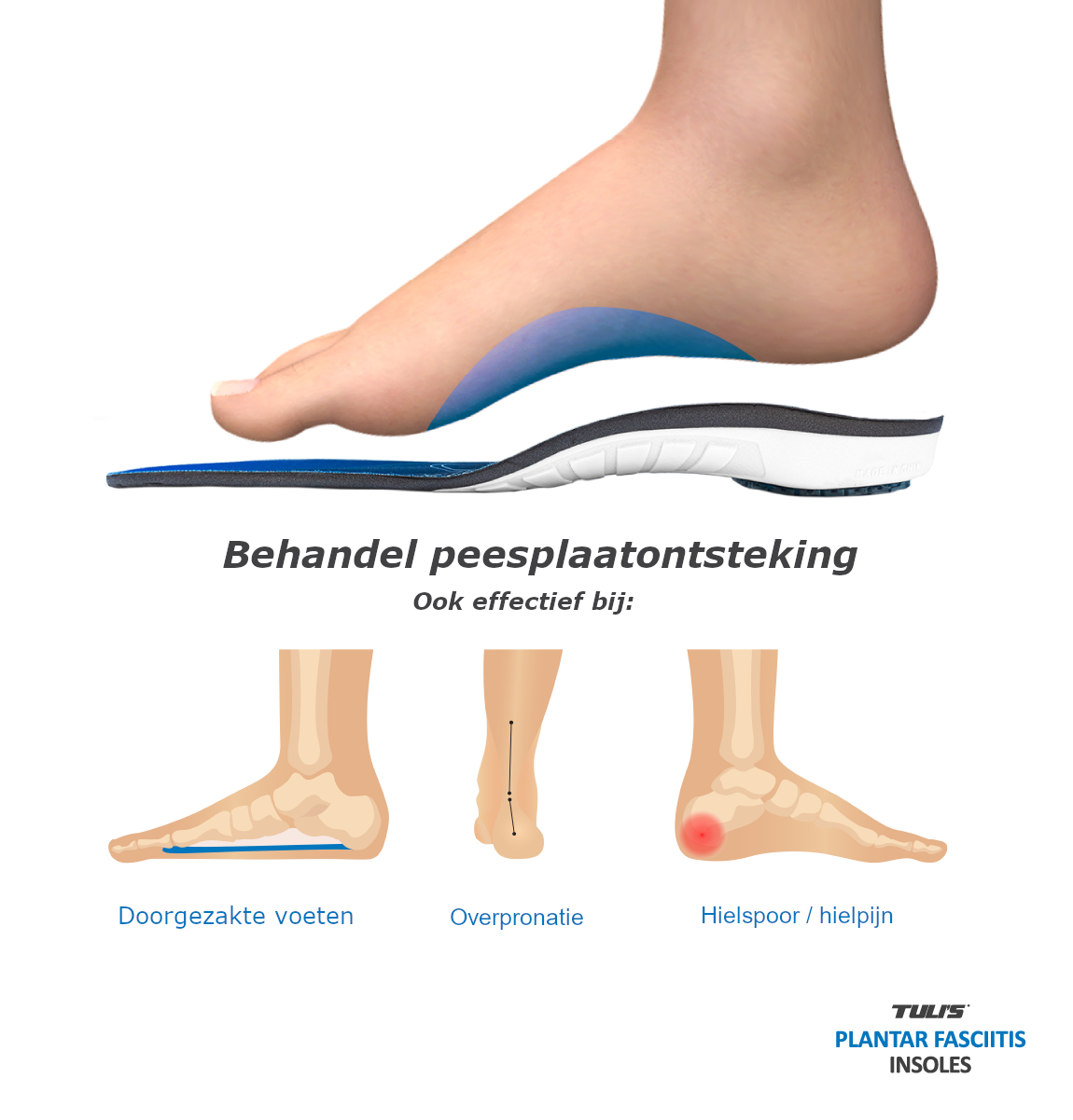 Tulis Plantarfaszien-Einlegesohlen