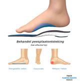 Tulis Plantarfaszien-Einlegesohlen